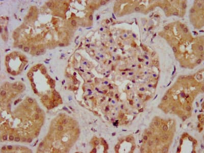 Polyclonal Rabbit anti-Human AGXT2 Antibody (IF, WB)