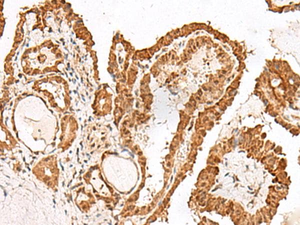 GRASP Antibody
