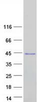 Human LIX1L Protein (Recombinant Myc-DDK (Flag))