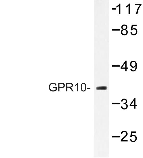 PRLHR / GPR10 Antibody (Gln223)