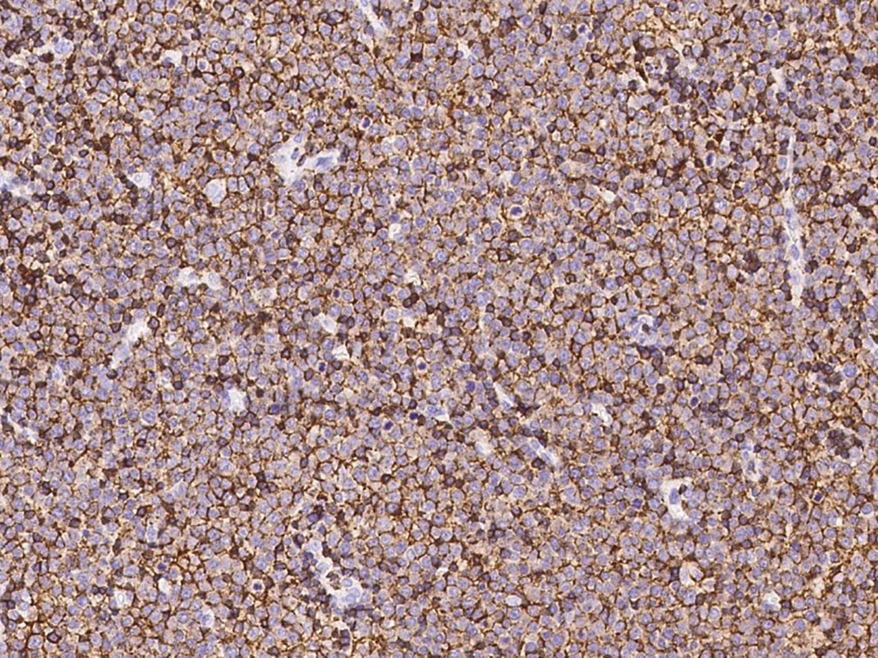 CD45 / LCA Antibody (clone 101, Preservative Free)