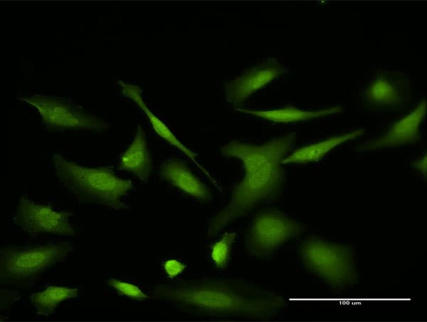 VDAC2 Antibody (clone 3D2)