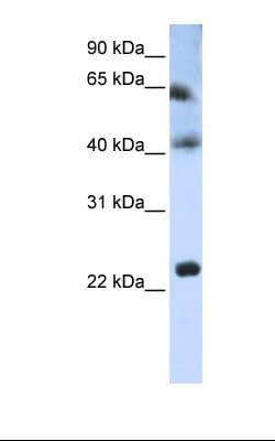 Polyclonal Rabbit anti-Human TSPAN3 Antibody (aa110-159, WB)