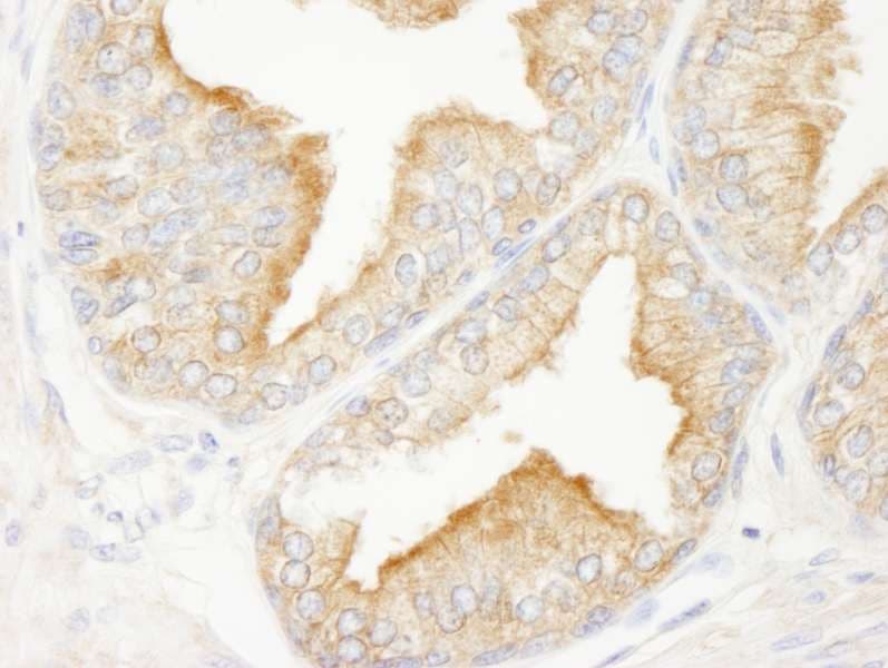 KANK2 Antibody (aa550-600)