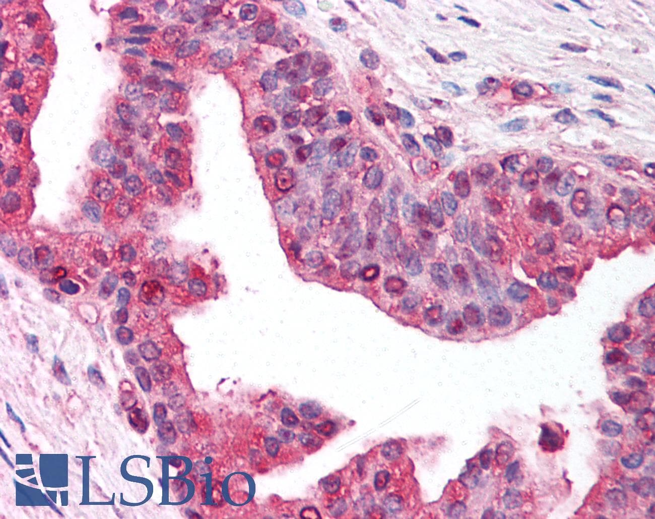 IHC-plus™ Monoclonal Mouse anti-Human YWHAG / 14-3-3 Gamma Antibody (clone KC21, N-Terminus, IHC)