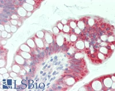 IHC-plus™ MTTP / MTP Antibody (aa878-911)
