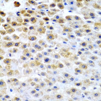 TFPI2 Antibody