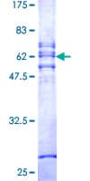 Human CA11 / Carbonic Anhydrase XI Protein (Recombinant GST)
