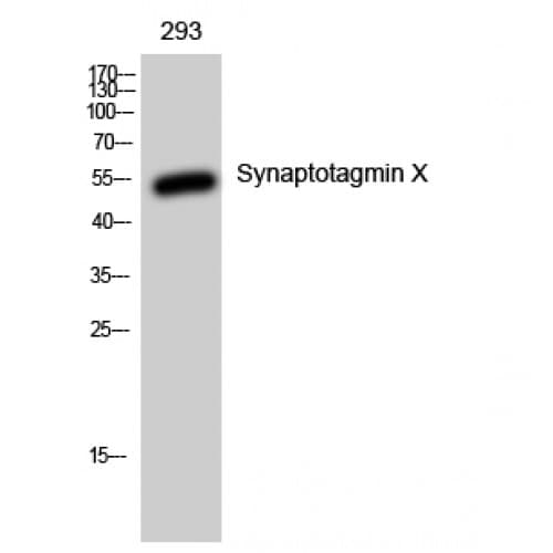 SYT10 / Synaptotagmin X Antibody (380-460 aa, C-terminal)