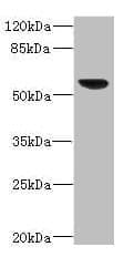 SOAT2 Antibody