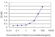 Monoclonal Mouse anti-Human TFB1 / GTF2H1 Antibody (clone 1F12-1B5, IF, WB)