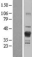 LCMT1 Protein (Over-Expression Lysate Myc-DDK (Flag))