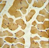 Polyclonal Rabbit anti-Human SPHK / SPHK1 Antibody (aa313-343, IHC, WB)