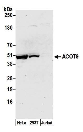 ACOT9 Antibody (aa389-439)