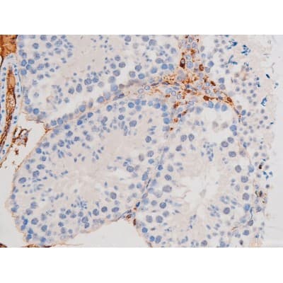 STAT1 Antibody (phospho-Ser727)