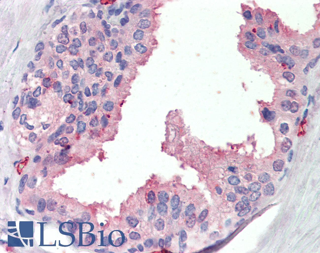 IHC-plus™ 5-Alpha Reductase / SRD5A1 Antibody (aa173-184)