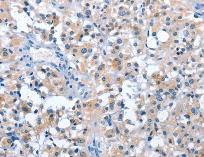 ASB2 Antibody