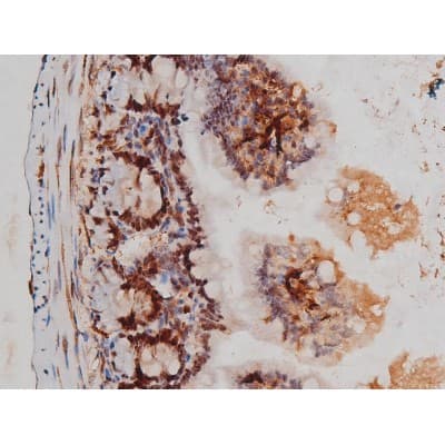 Polyclonal Rabbit anti-Human MAPT / Tau Antibody (phospho-Thr205, IHC, WB)