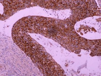 Monoclonal Mouse anti-Human EGFR Antibody (IHC, WB)