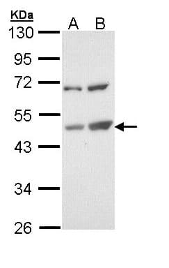 TSPYL1 Antibody (aa1-203)