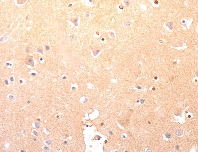 CAPNS1 / CAPN4 Antibody