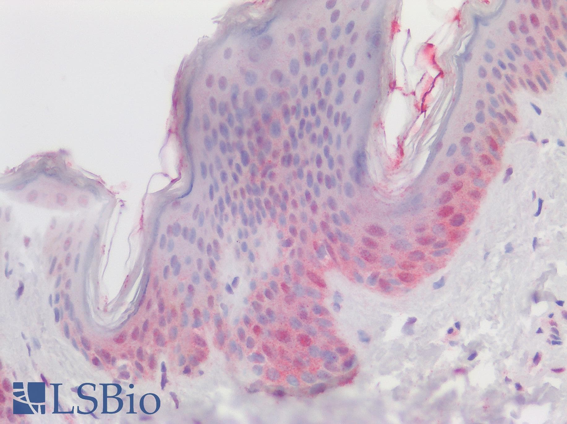 IHC-plus™ Polyclonal Rabbit anti-Human DKK1 Antibody (Internal Region, IHC, WB)
