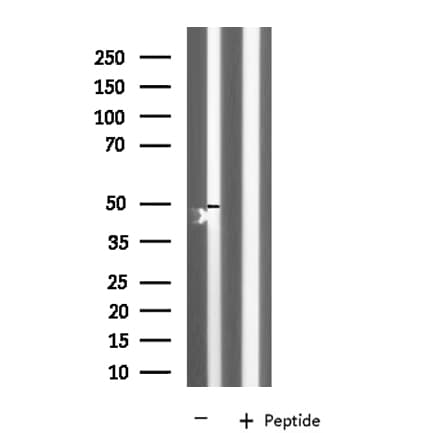 KCNK12 Antibody