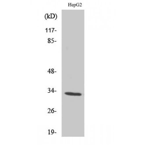 OR2T2 + OR2T35 Antibody (30-110 aa, Internal)