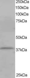 IHC-plus™ CYTIP Antibody (aa2-14)