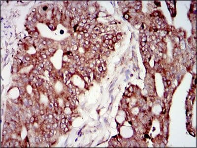 Monoclonal Mouse anti-Human PIK3R1 / p85 Alpha Antibody (clone 6G10, Amino Acid: 159-388, IHC, IF, WB)