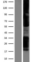 TBX21 / T-bet Protein (Over-Expression Lysate Myc-DDK (Flag))