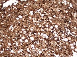 Monoclonal Mouse anti-Human GAPDH Antibody (clone OTI2F9, IHC, WB)