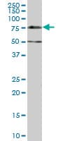 Monoclonal Mouse anti-Human SMIF / DCP1A Antibody (clone 2G10, WB)