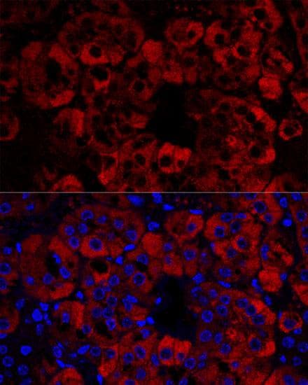 STAR Antibody