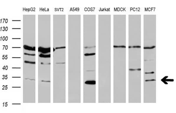 Monoclonal Mouse anti-Human BCL2 / Bcl-2 Antibody (clone OTI3B8, IHC, WB)