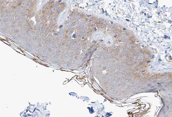ETK / BMX Antibody (phospho-Tyr566)