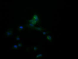 APCS / Serum Amyloid P / SAP Antibody (clone OTI1D6, Carrier-free)