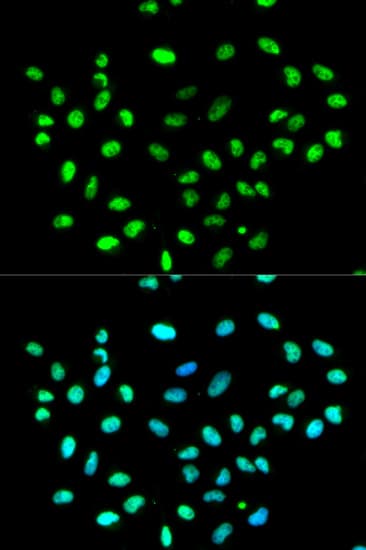 Polyclonal Rabbit anti-Human HNRNPK / hnRNP K Antibody (IHC, IF, WB)