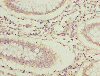 Polyclonal Rabbit anti-Human ARPIN / C15orf38 Antibody (IHC, WB)