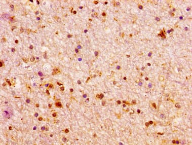 ARX Antibody