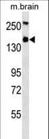 IHC-plus™ Hamartin / TSC1 Antibody (clone 357CT4.4.2)