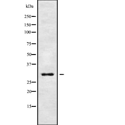 GPM6B Antibody