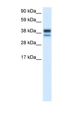 MAPK14 / p38 Antibody (C-Terminus)
