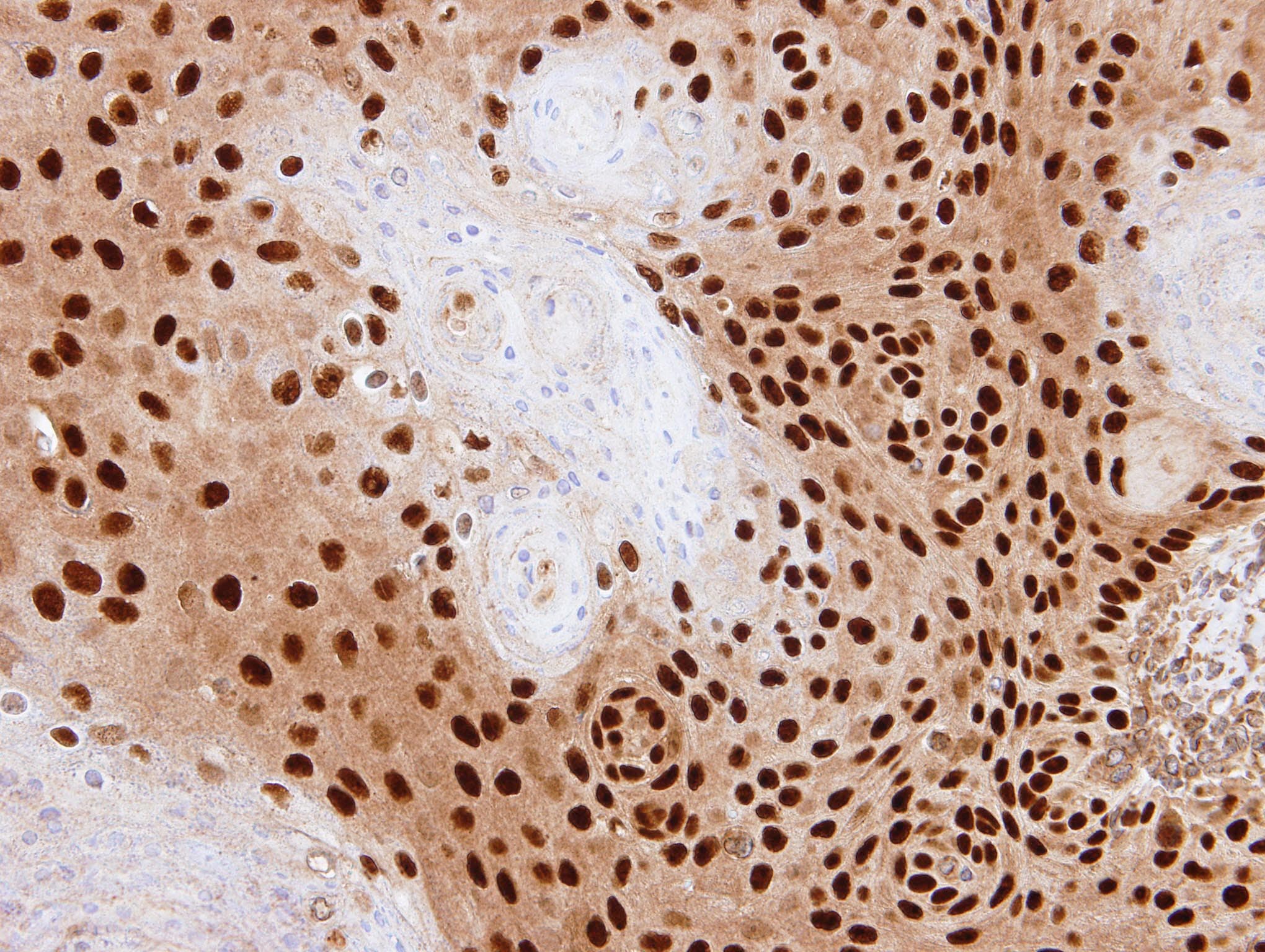 Polyclonal Rabbit anti-Human PDE6D / PDE6 Delta Antibody (aa1-150, IHC, WB)