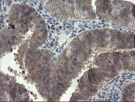 FBXO42 / JFK Antibody (clone OTI1H4)