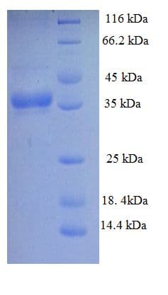 Mycobacterium tuberculosis pstS1 Protein (Recombinant His)
