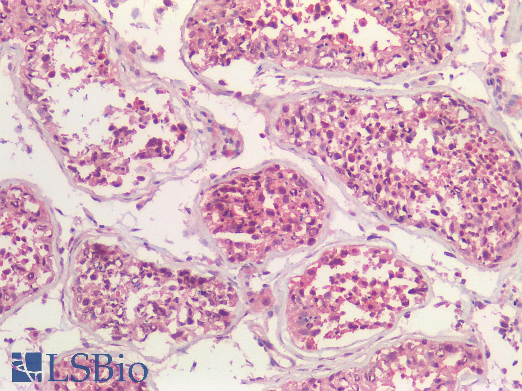 IHC-plus™ VPS35 Antibody (Internal Region)