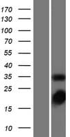 TS / Thymidylate Synthase Protein (Over-Expression Lysate Myc-DDK (Flag))
