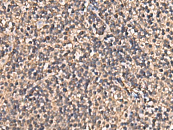 Polyclonal Rabbit anti-Human PLEKHF2 Antibody (IHC, WB)