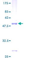 Human SEC22B Protein (Recombinant GST)